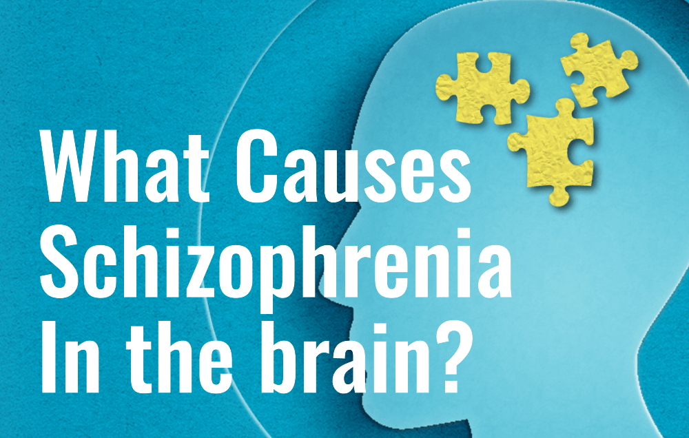 What Causes Schizophrenia In the brain?